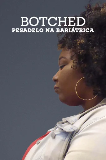 Assistir Botched: Pesadelo na Bariátrica Online